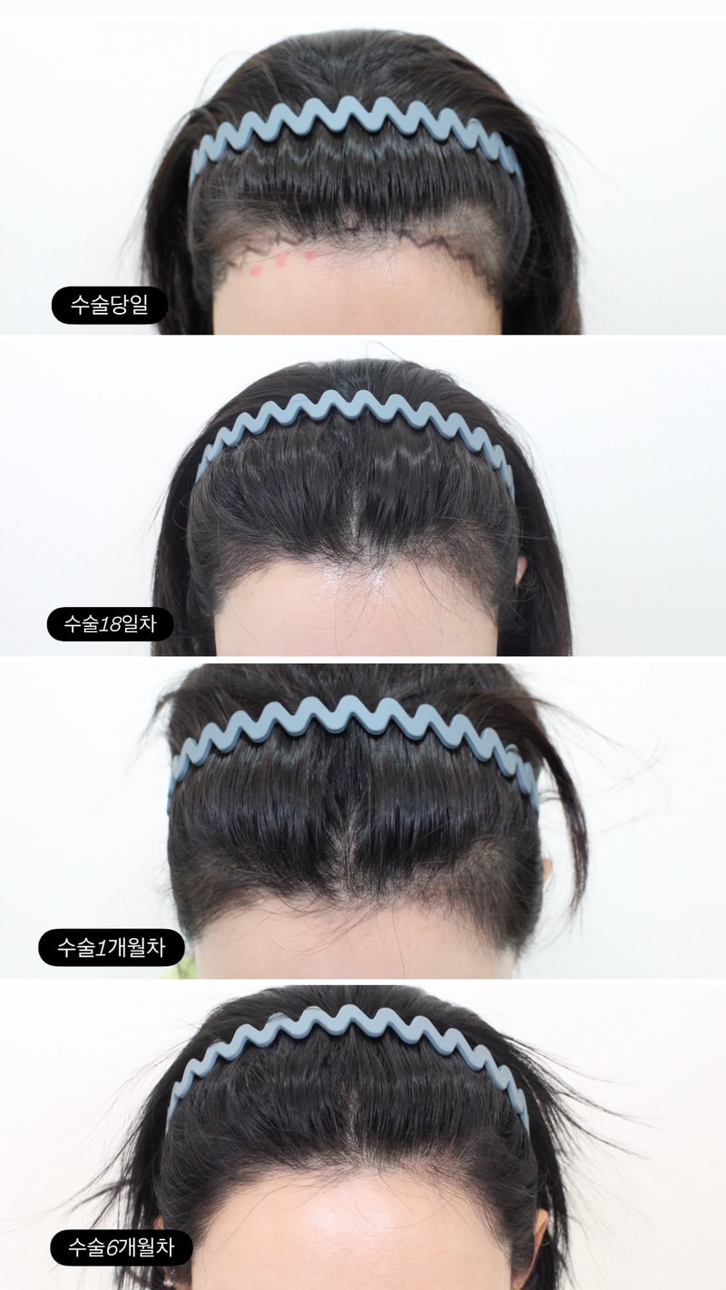 포토후기 이미지