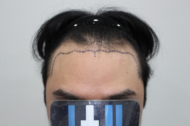 포토후기 이미지