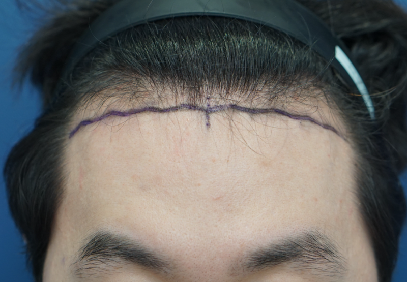 포토후기 이미지