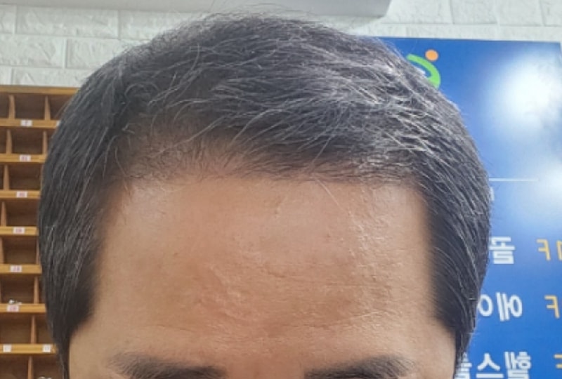 포토후기 이미지