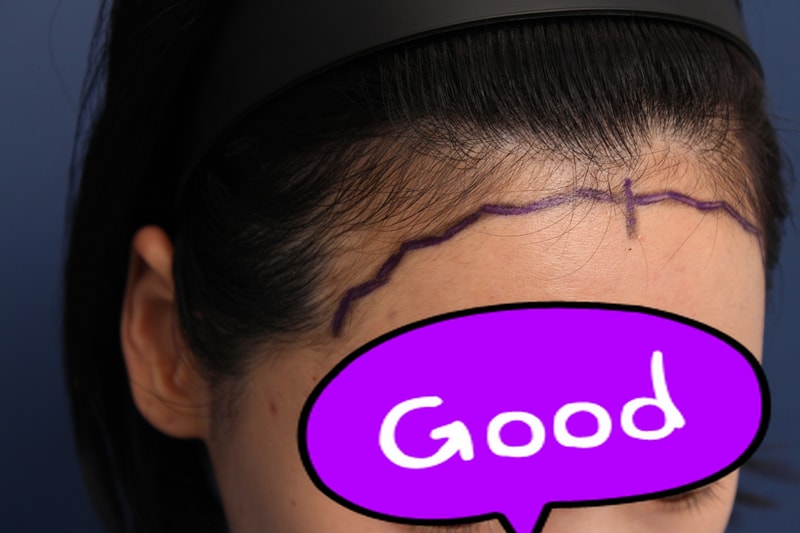 [꾸미기]박연수 수술전-2.JPG