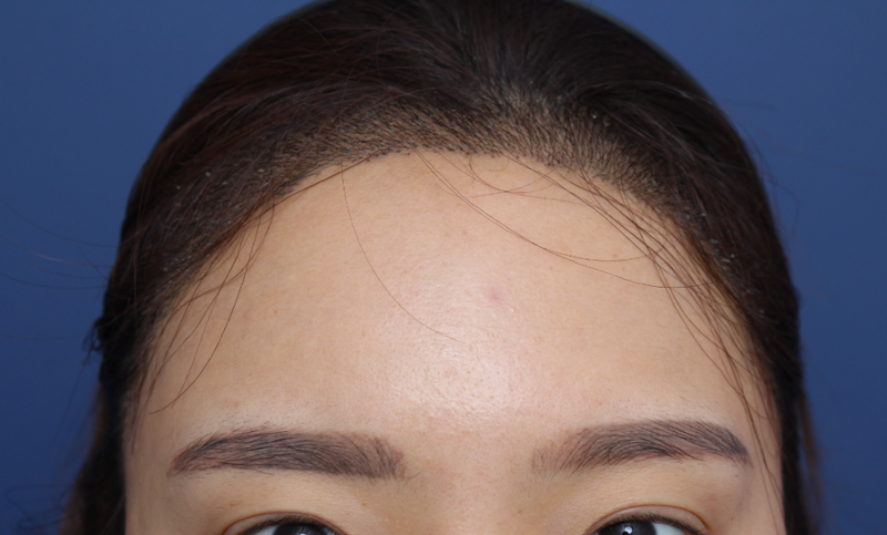 포토후기 이미지