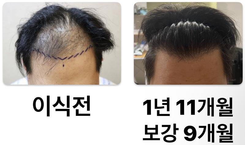 It's been a year and 11 months