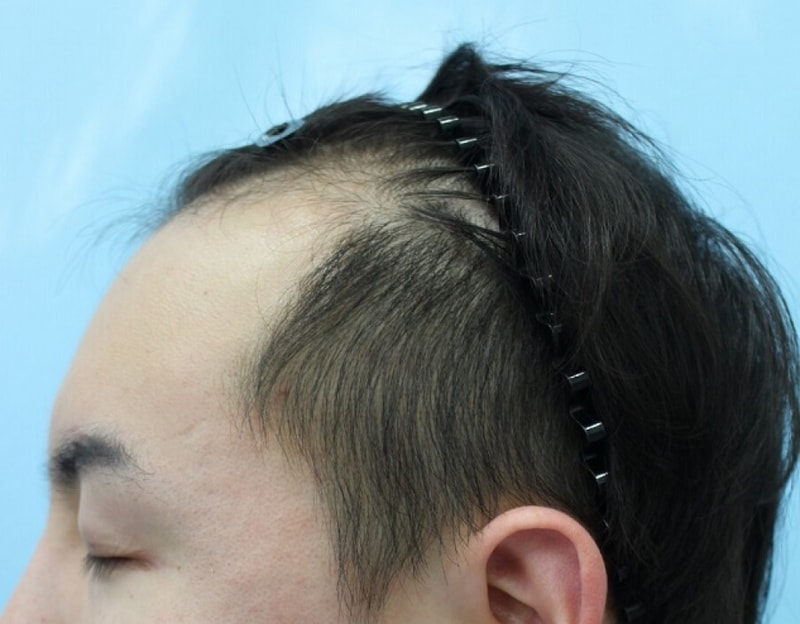 측면`.jpg