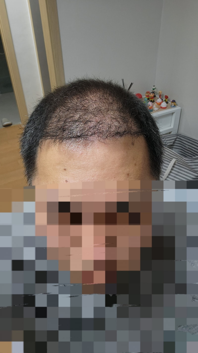 후1.jpg