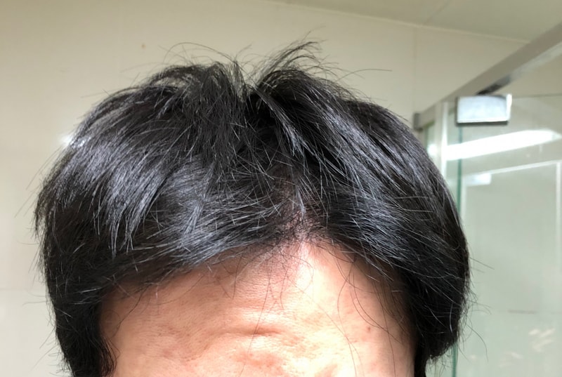 移植してからもう8ヶ月が経ちました。