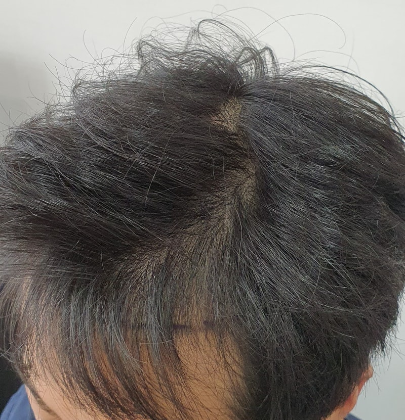 가르마.jpg