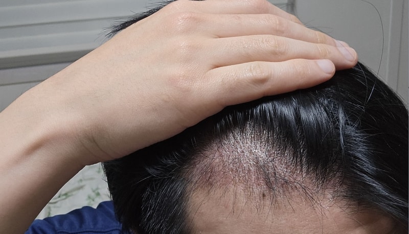 40일 좌.jpg