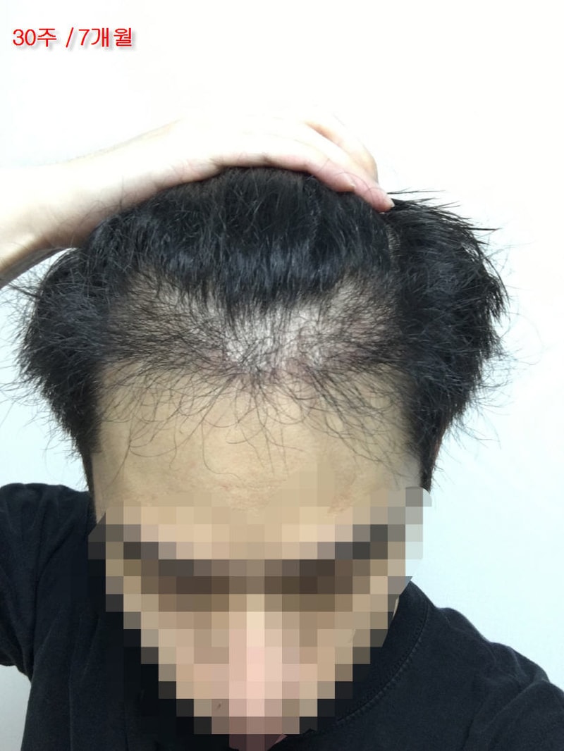 30.210일차7개월.jpg