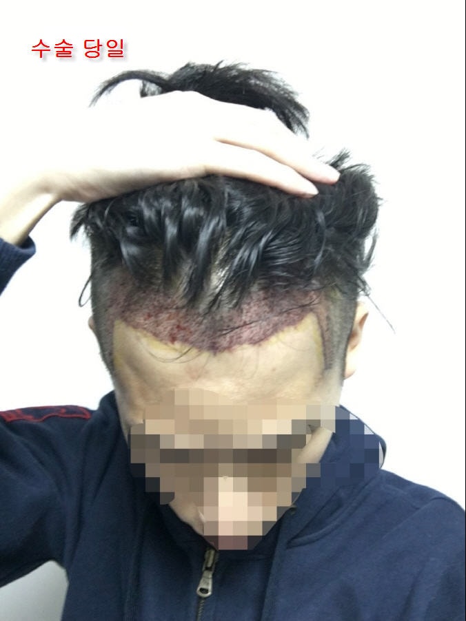 00.수술 당일.jpg