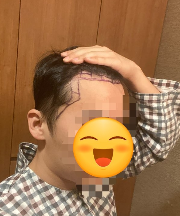 수술전 디자인2.PNG
