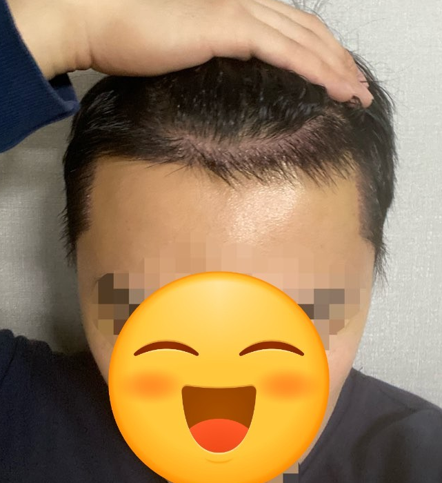 정면.PNG