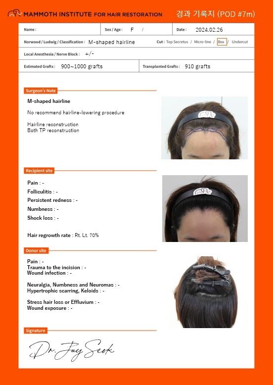 [Hairline] Apgujeong Mamos Women's Hairline 6 Months Review