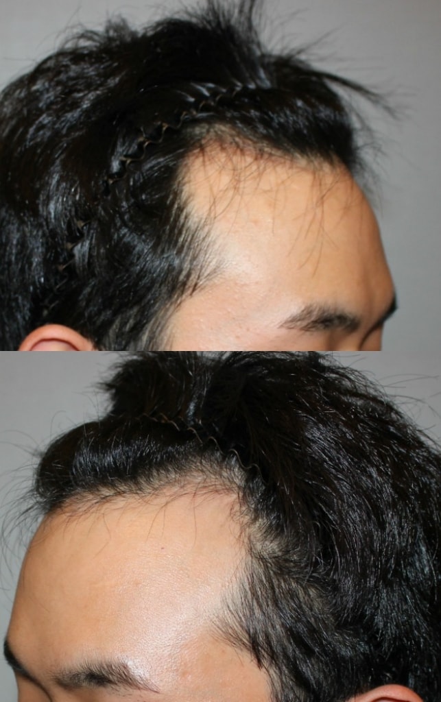 뿌잉3.jpg
