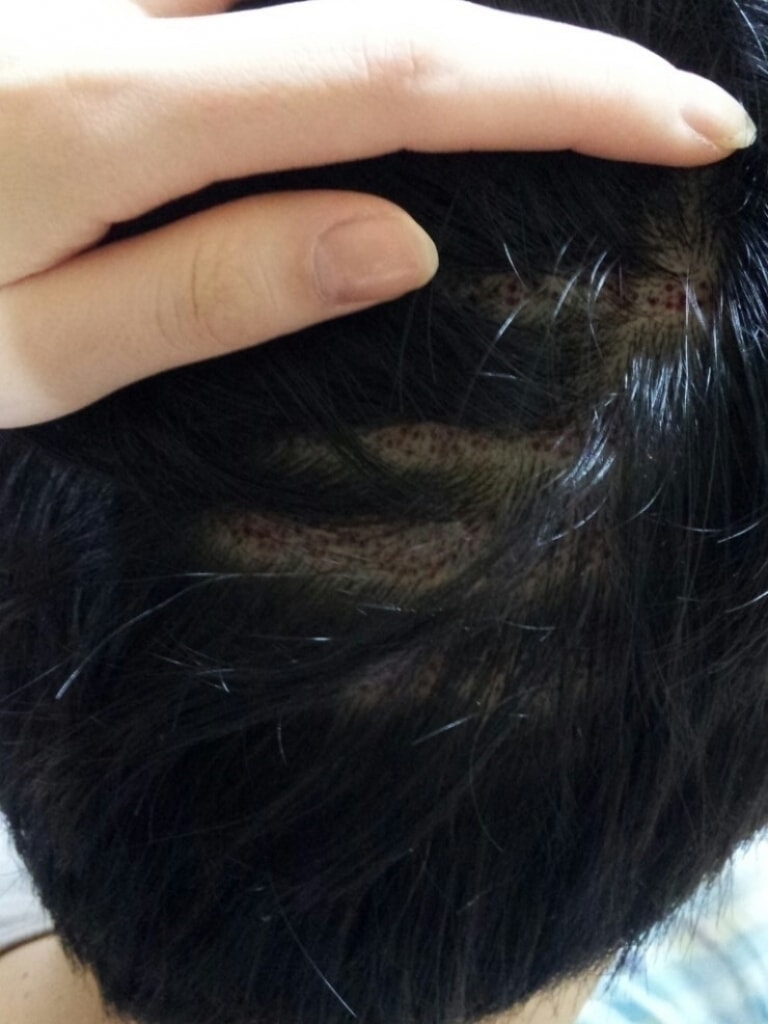 후두부.JPG
