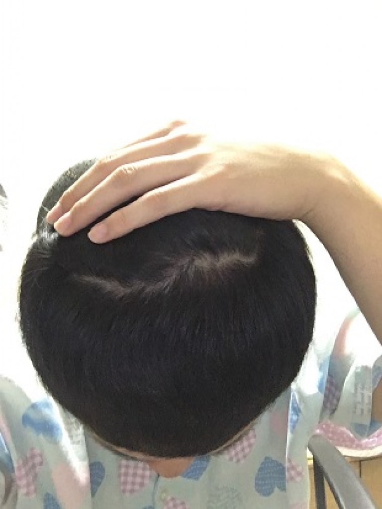 앞머리깐거2.JPG