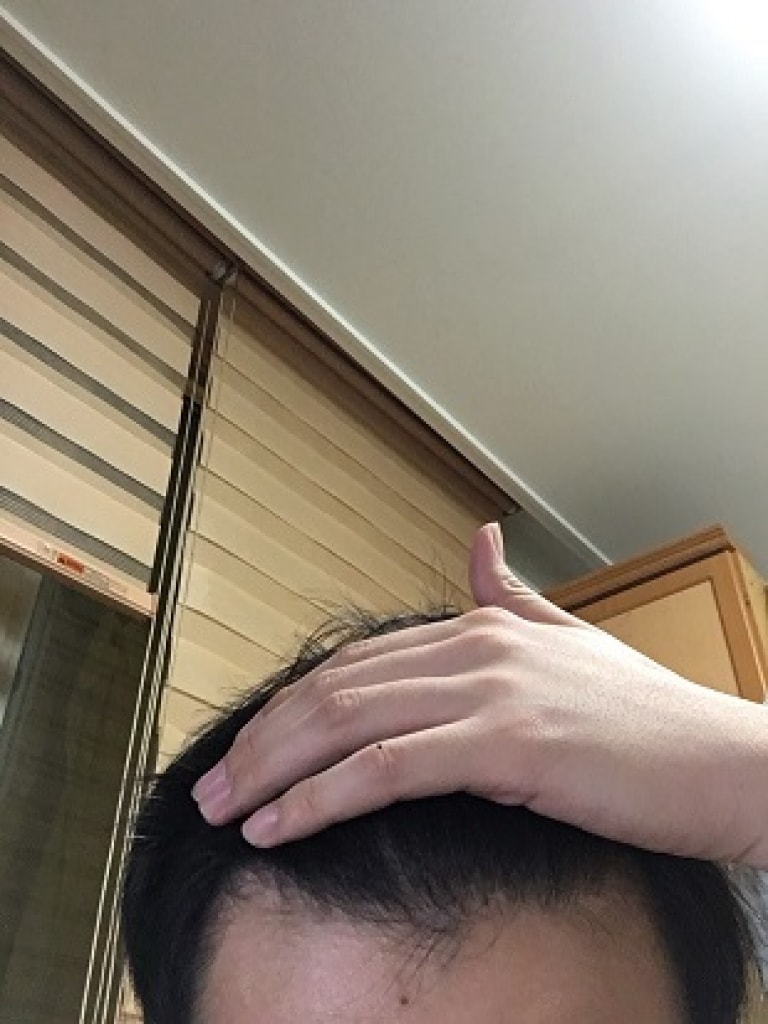 앞머리.JPG