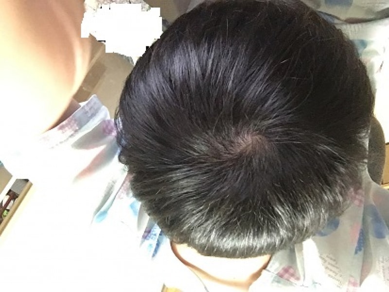 정수리.JPG