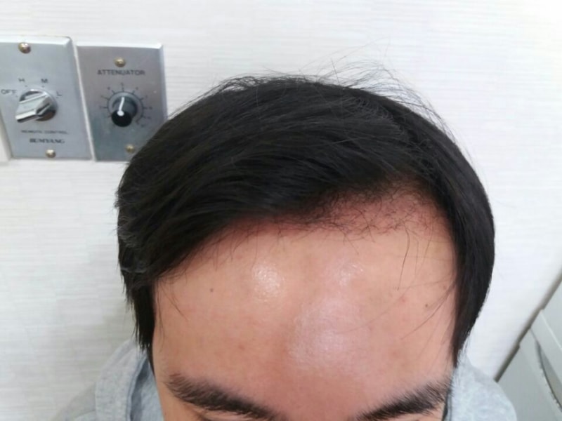 KakaoTalk_Moim_5SdY6oNQM3YzpeGHD9iHpfdYd0Shx0.jpg