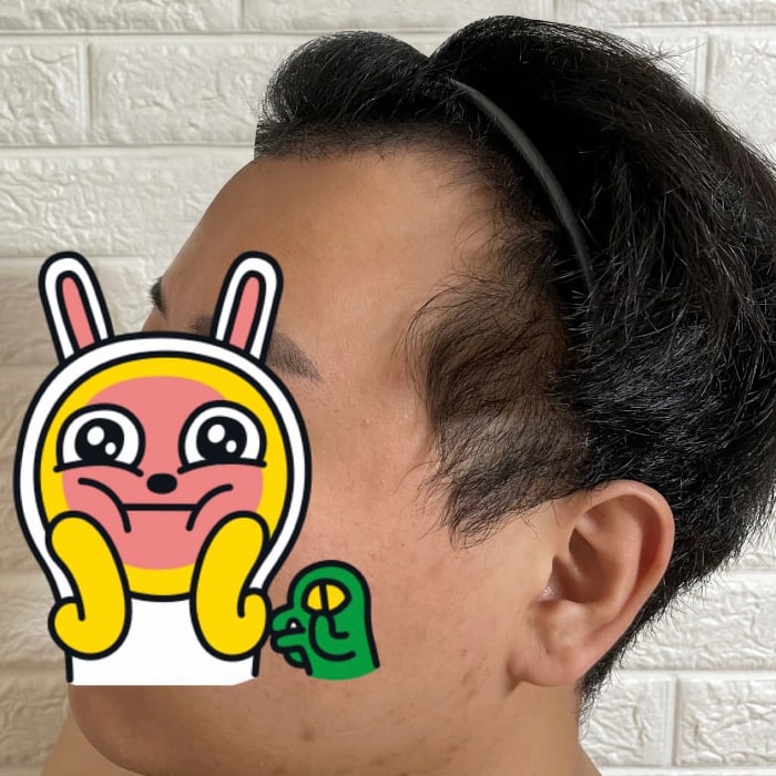 전 왼.jpg