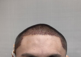 1.PNG