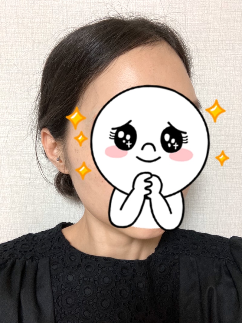 在Dana做手术才一个月。 是后记~