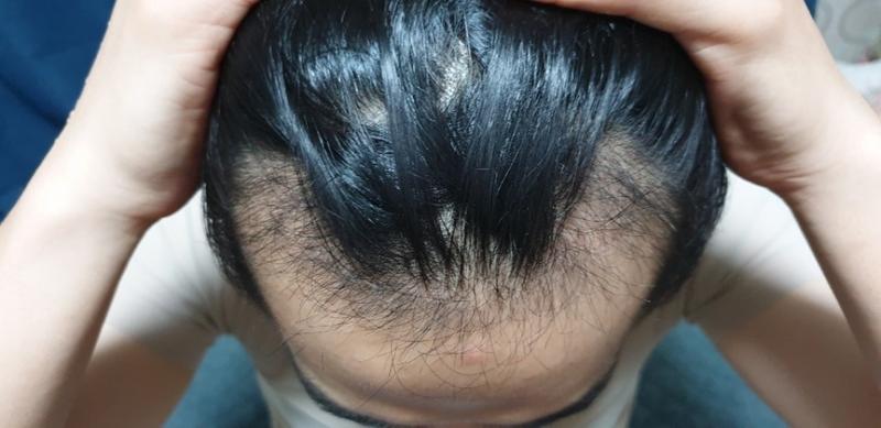 This is the review of the 50th day of the M-shaped non-cut 3016 Mo.