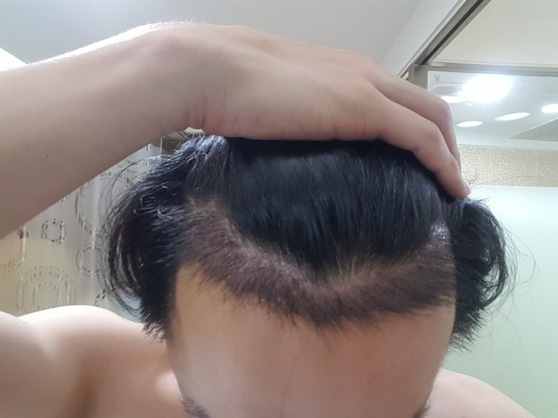 20170817_173556.jpg