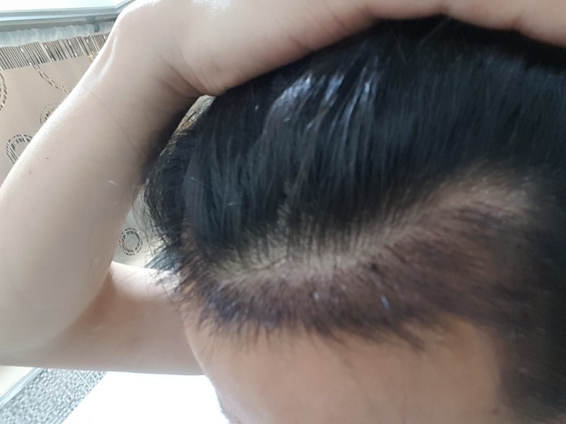 20170817_173535.jpg