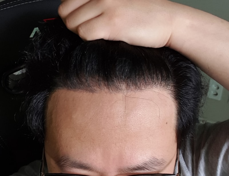 It's been 8 months since I opened my eyes