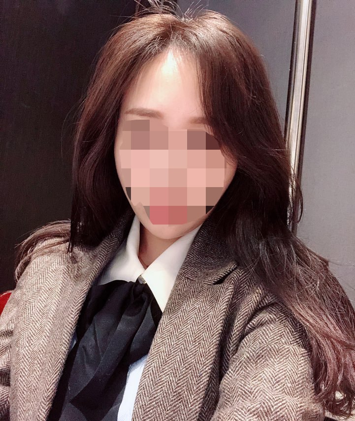 다나에서 헤어라인 절개 세달 됐어요~^^