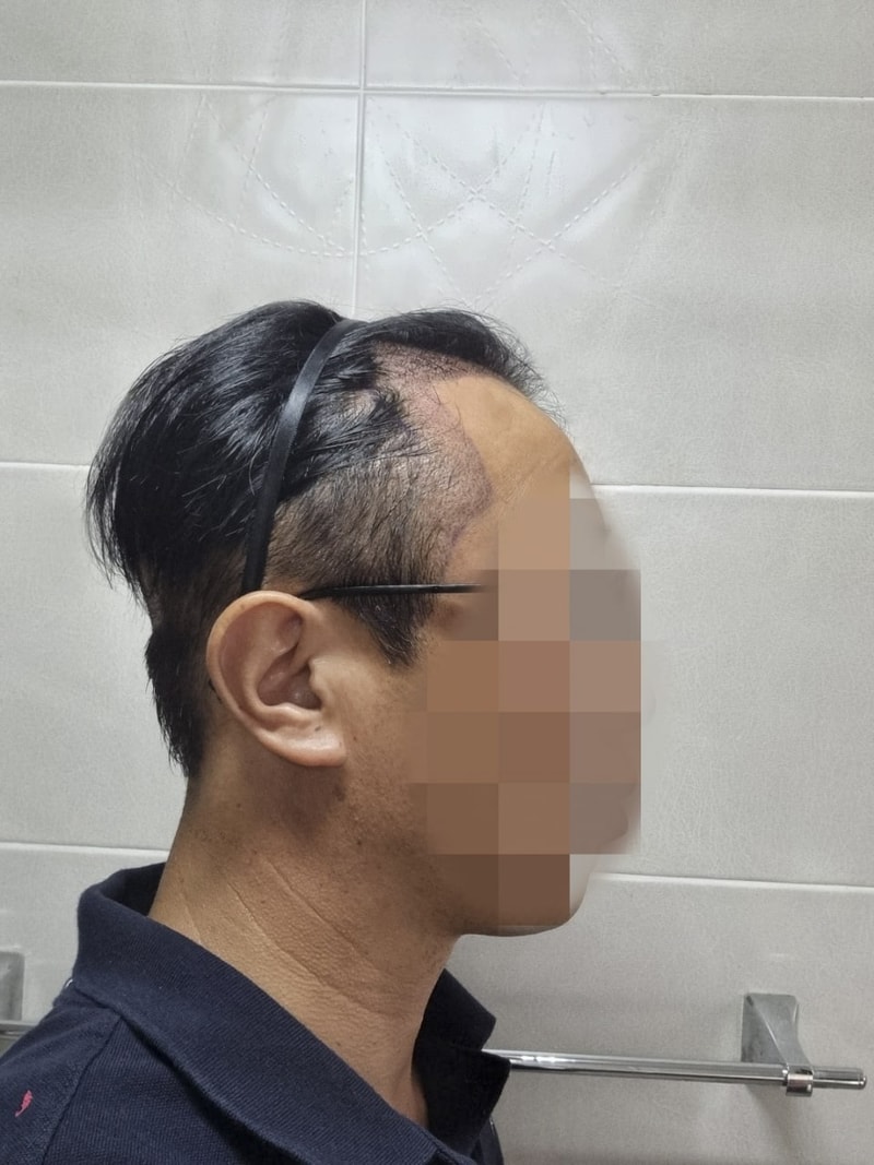 수술 후 우측.jpg