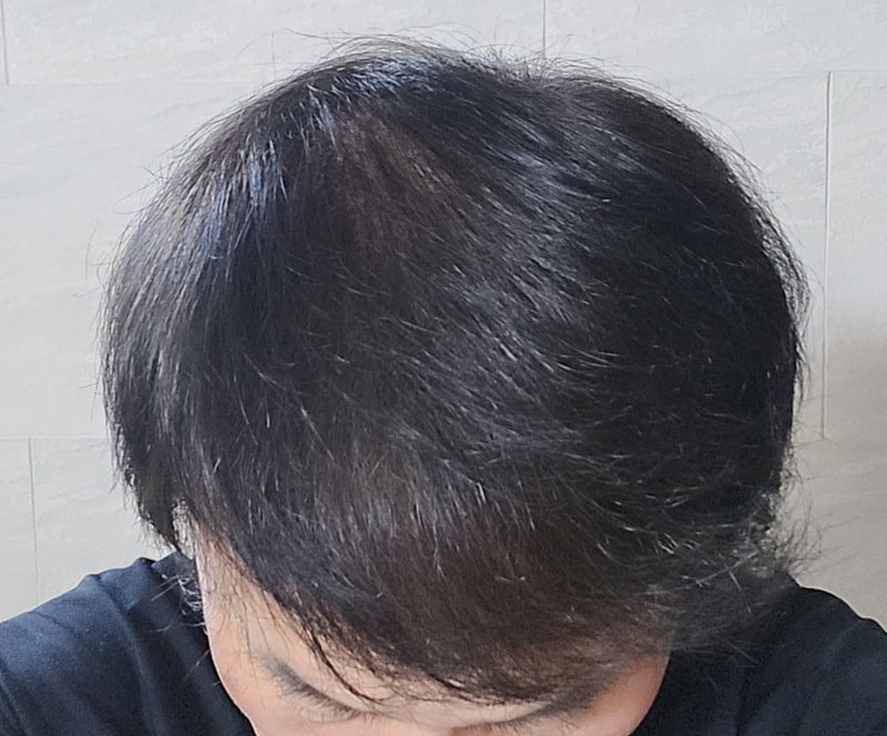 1000020077.jpg