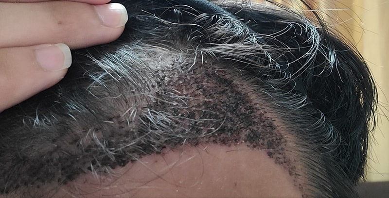 [modie hair plant] 切开后记