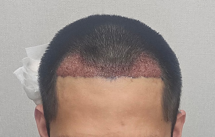 포토후기 이미지