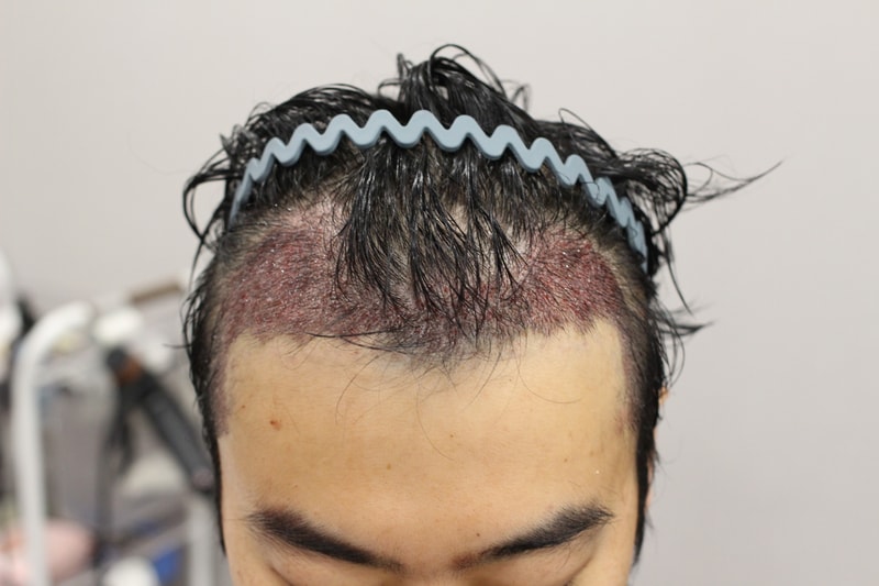 1000022642.jpg