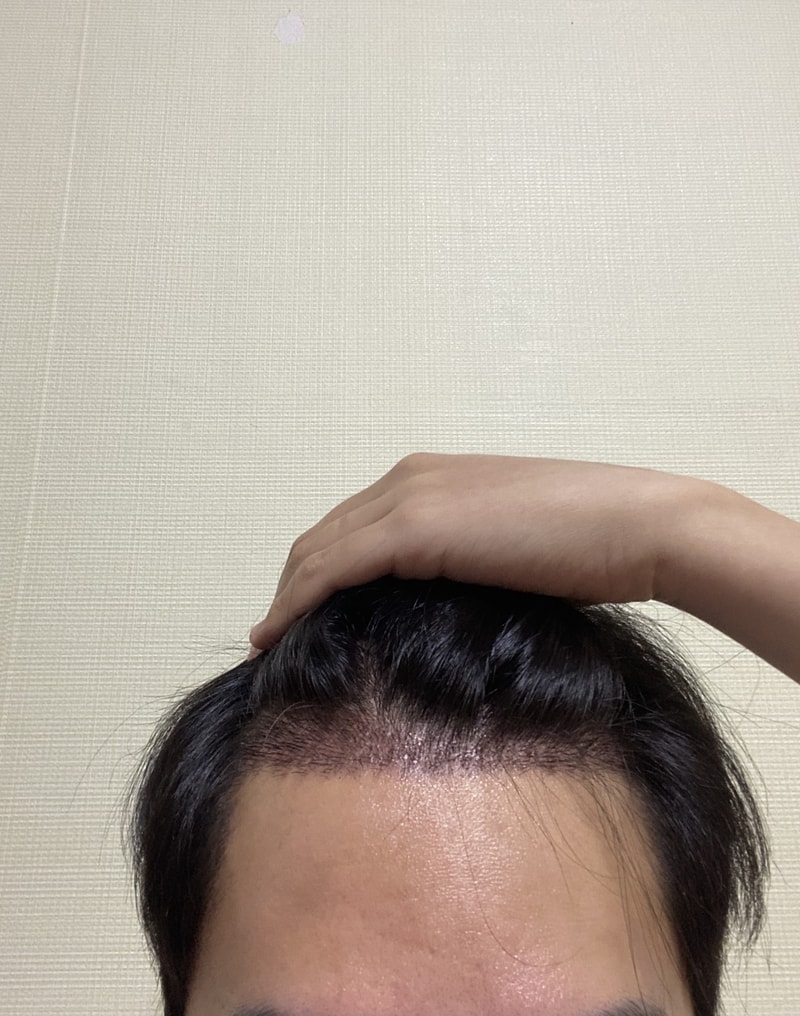 B3EDFE6B-8CF3-48B4-B842-DEBD81744231.jpeg