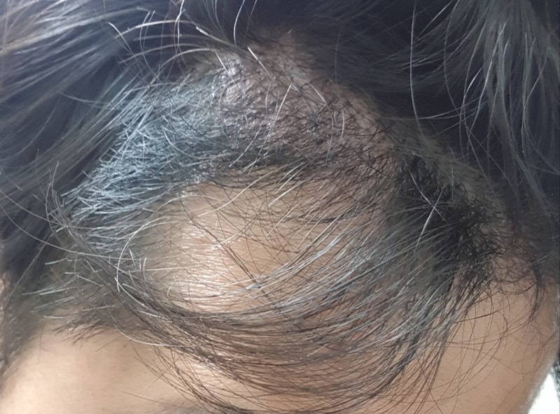 5개월하고 9일지났습니다. 확인부탁드려요