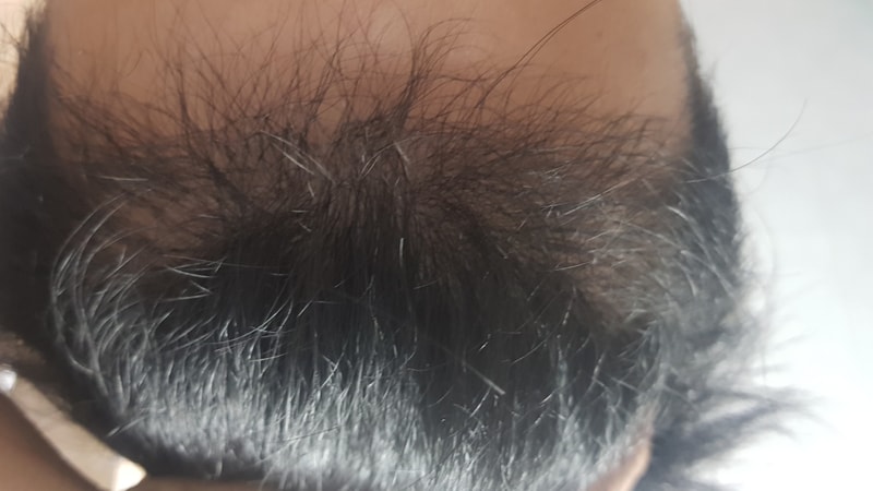 5개월 6개월 보름 사진입니다 ㅎㅎ