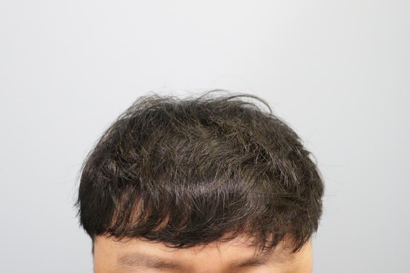 光州狎鸥亭Mobian医院经过10个月后的后记