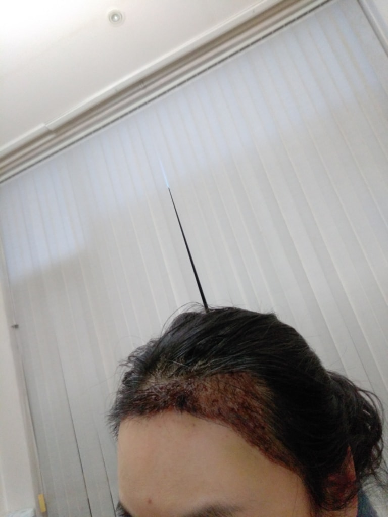 IMG_20180205_181321.jpg