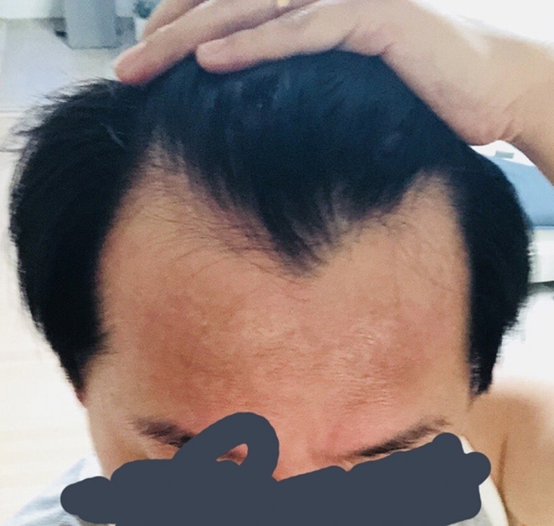 留下似梦非梦的后记（非切开2600毛）