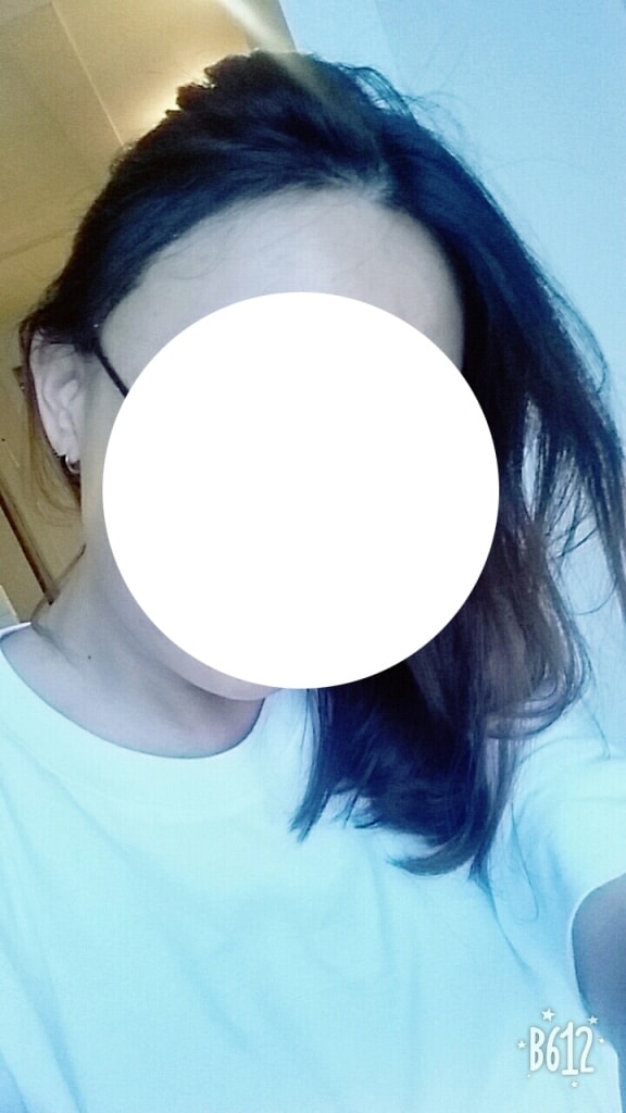 术后15天