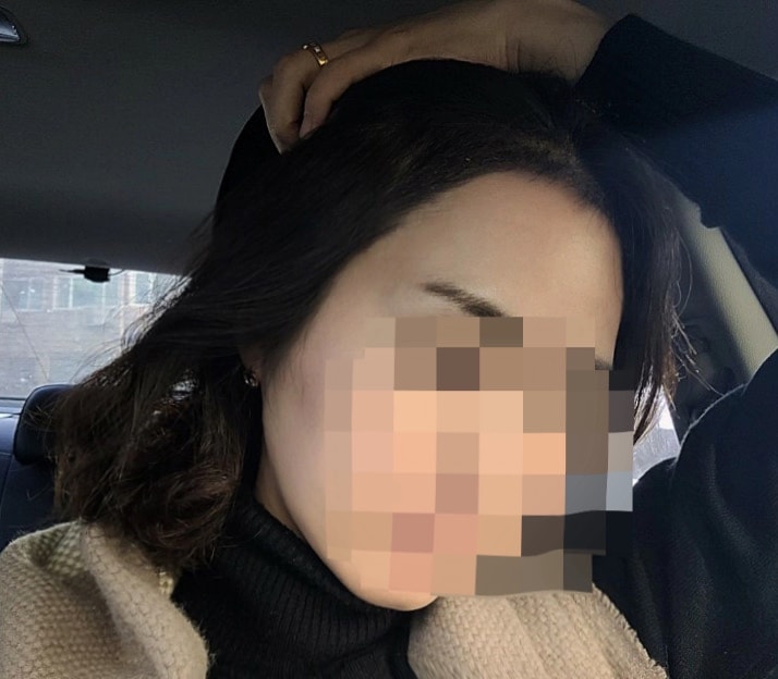 다나 절개3800모 1~10일차후기