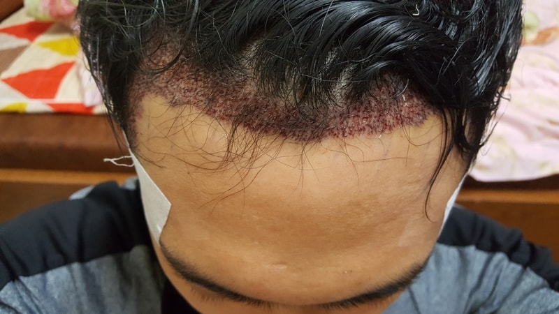 20180421_191323.jpg