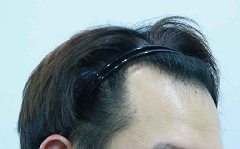 수술전2.jpg