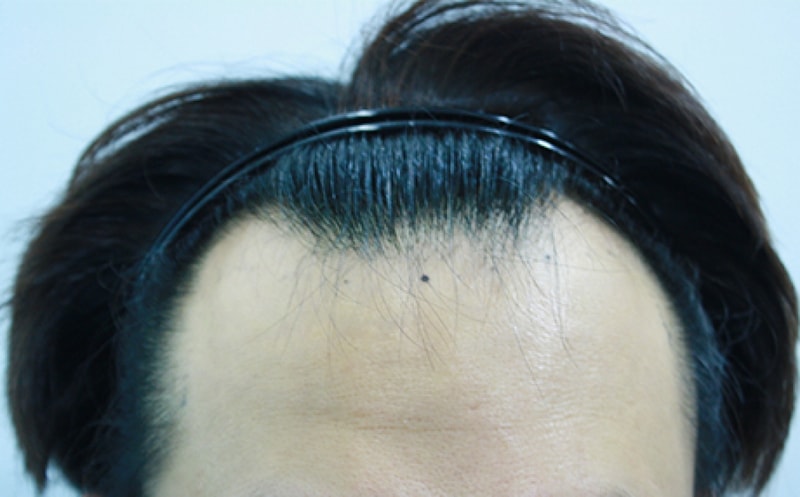 수술전1.jpg