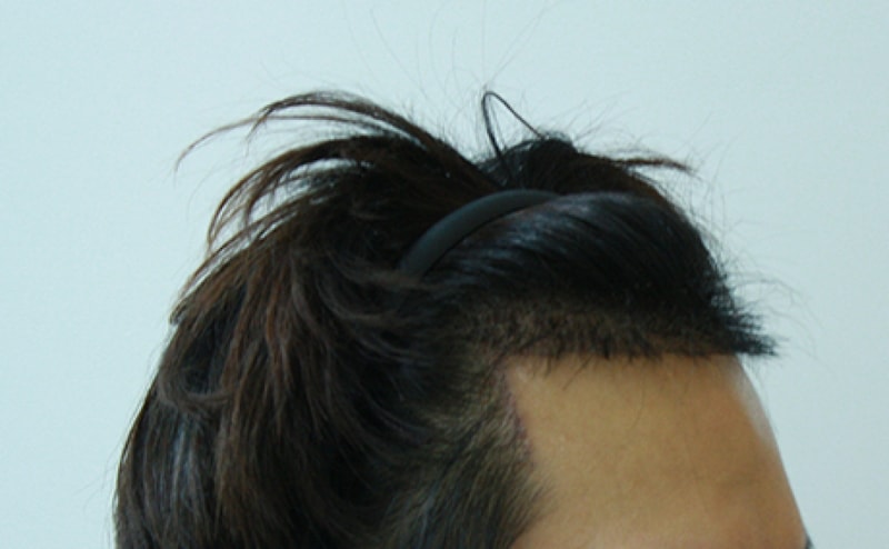 수술후2.jpg