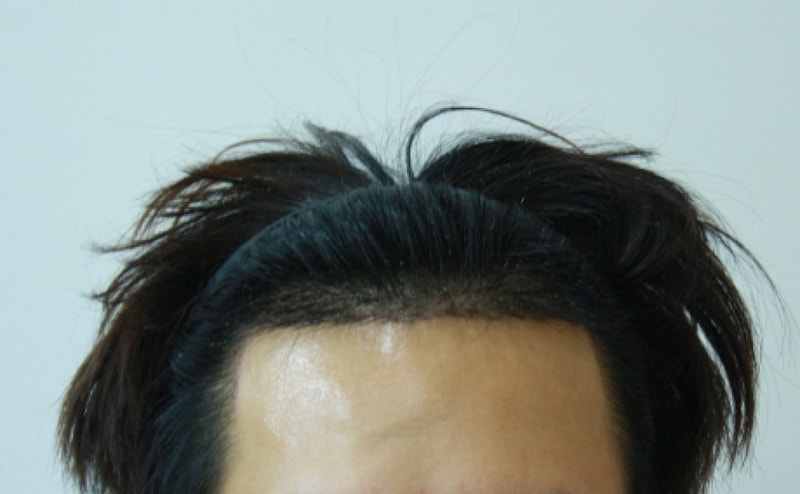수술후1.jpg