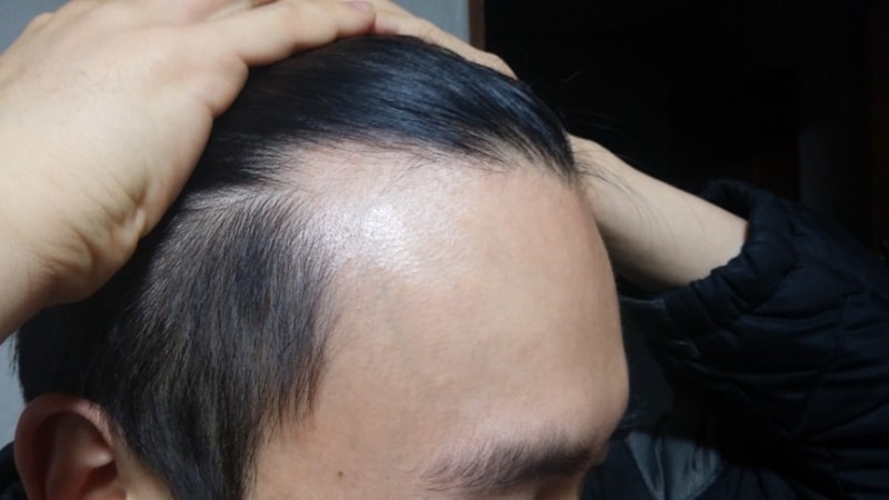 KakaoTalk_20170410_105335918.jpg